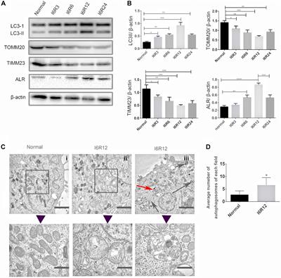 Augmenter of Liver Regeneration Protects Renal Tubular Epithelial Cells From Ischemia-Reperfusion Injury by Promoting PINK1/Parkin-Mediated Mitophagy